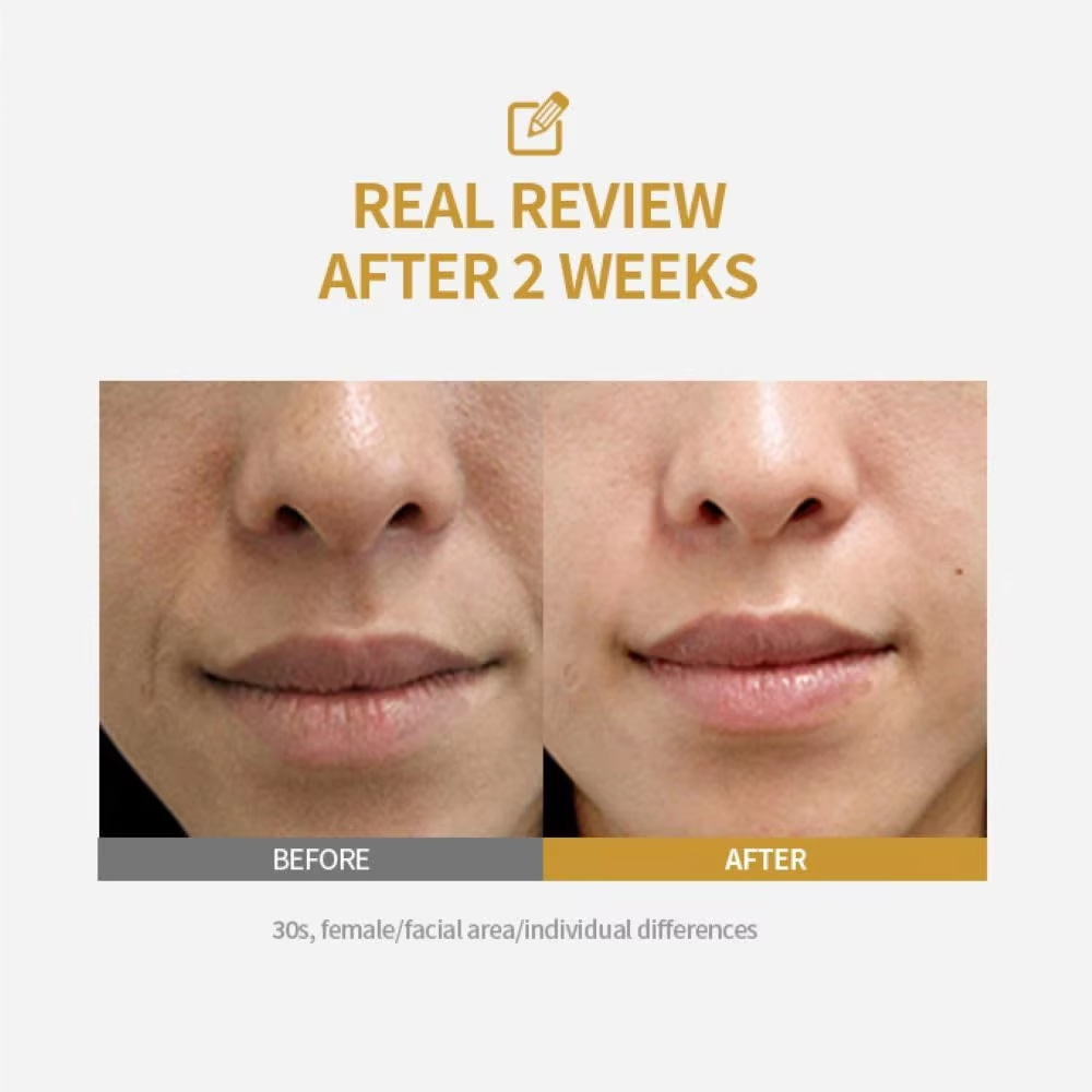 أمبولة مكثفة للرفع بالببتيد، س - مراجعة Collagen Peptide Powder وسعره